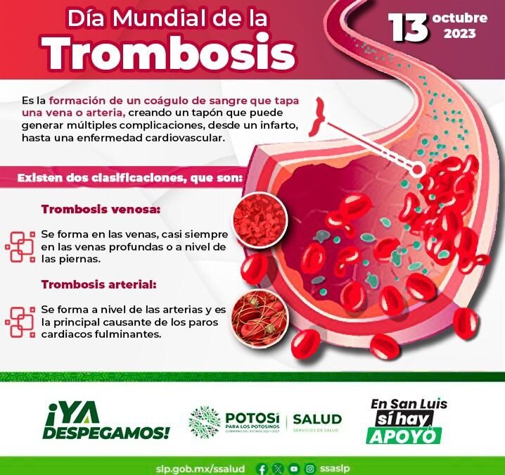 LA EDUCACIÓN Y CONCIENTIZACIÓN SON CLAVE EN LA LUCHA CONTRA LA TROMBOSIS.