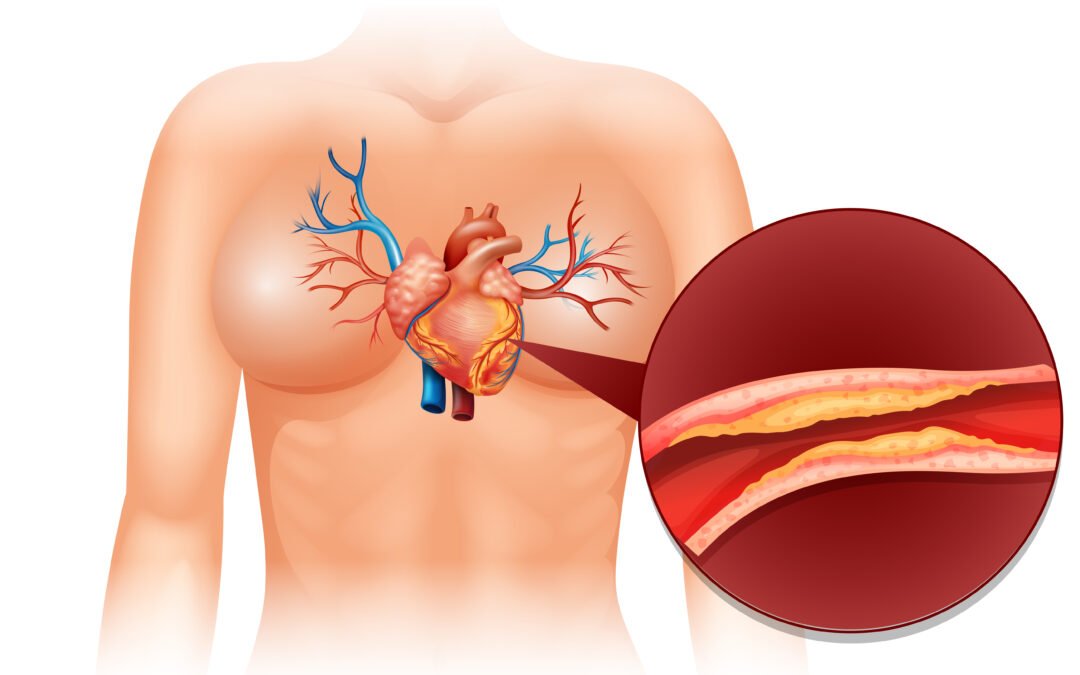 CONMEMORACIÓN DEL DÍA DE LOS TRIGLICÉRIDOS: IMPORTANCIA DE LA CONCIENTIZACIÓN Y PREVENCIÓN