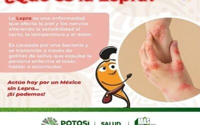 CONTINÚA SALUD CON ACCIONES DE PREVENCIÓN Y ATENCIÓN CONTRA LA LEPRA EN SLP