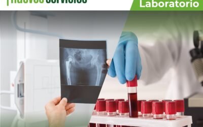 GOBIERNO ESTATAL BRINDA MÁS APOYO A PERSONAS CON DISCAPACIDAD